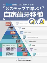 8ステップで学ぶ！自家歯牙移植 Q&A
