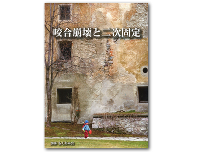 咬合崩壊と二次固定