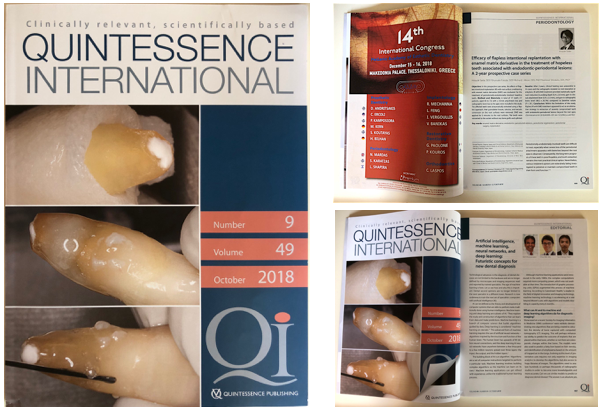 Front cover