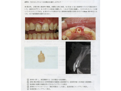 インプラント学会アンケート